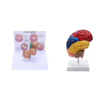 NEW-1 шт. Модель сосудистой патологии и 1 шт. Модель обучения ствола мозга с половиной мозга