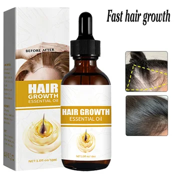 Масло для быстрого роста волос для мужчин Быстрое лечение биотином Сыворотка для облысения Масло для роста волос для чернокожих женщин Уход за волосами Лечение волос